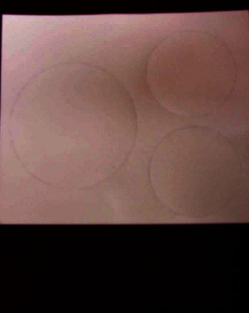 Buy Stick & Suck Placement Disks