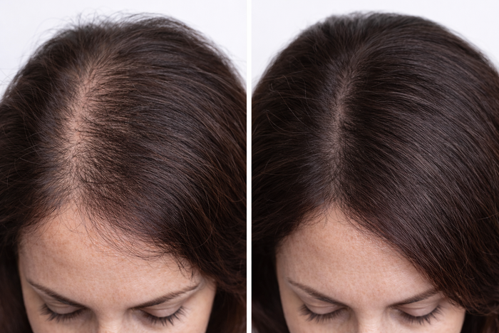 Before and after comparison of a woman's hair on a white background