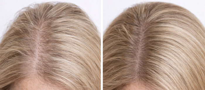 Before and after comparison of hair color on a person's head.